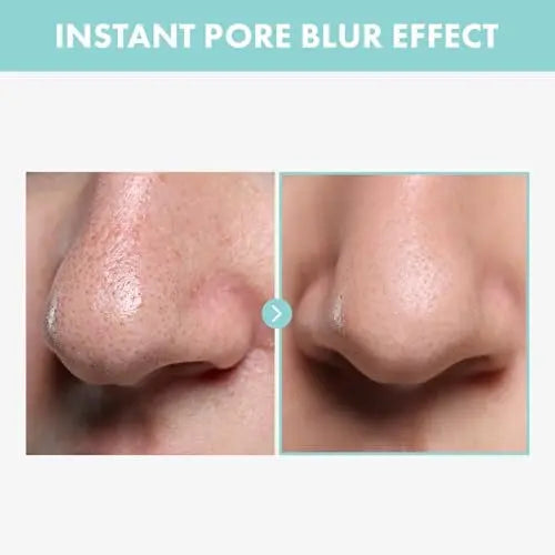 TOSOWOONG Pore Tightening Serum - Niacinamide & Allantoin Pore Minimizer for Face, 30ml Avelisse