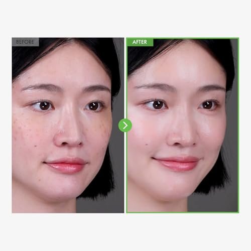 TOSOWOONG Kakadu Plum Blemish Cream – Dark Spot Remover & Brightening Face Cream with 600,000ppm Kakadu Plum Extract, Niacinamide & Adenosine – Korean Skin Care, 1.76 oz - görsel 6