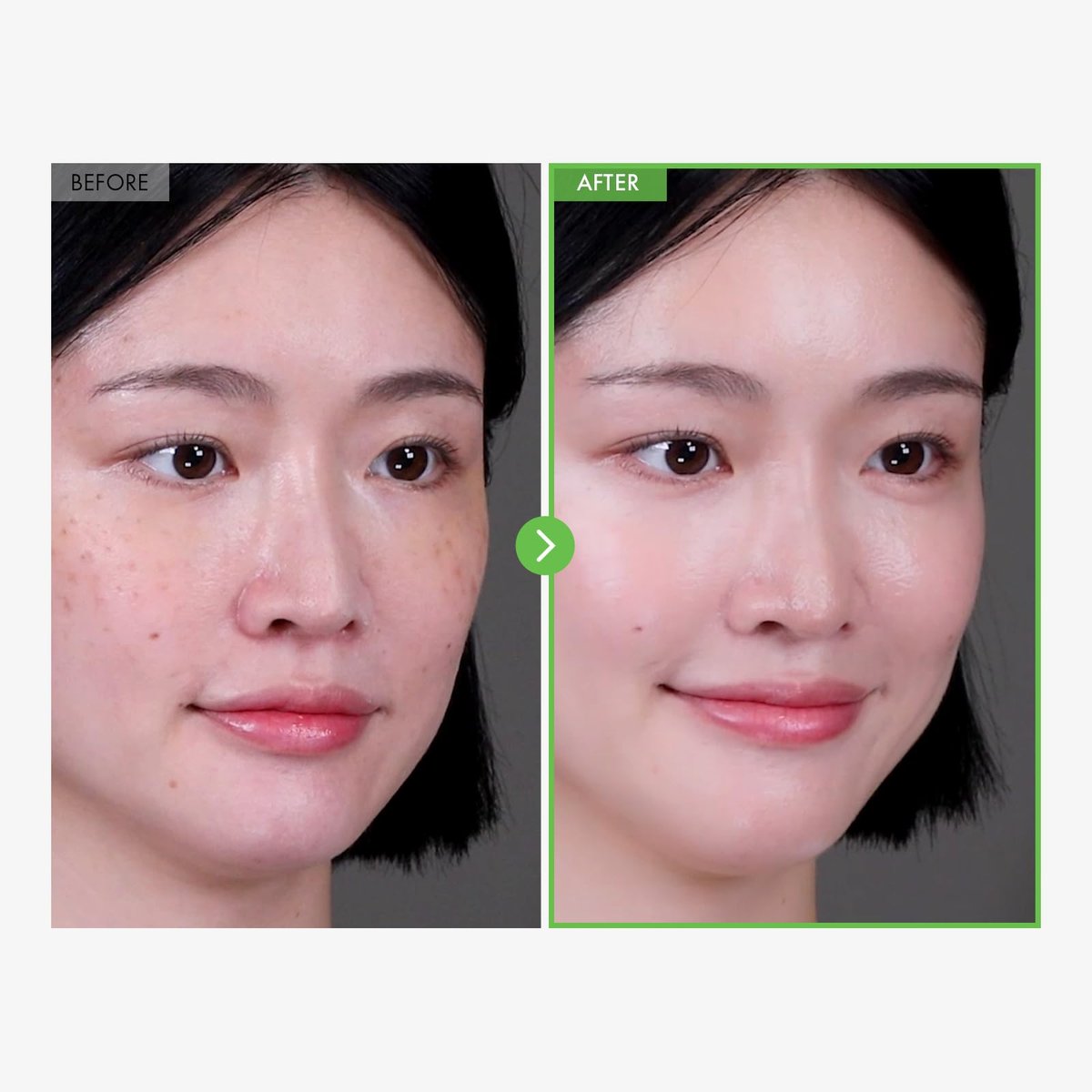 TOSOWOONG Kakadu Plum Blemish Cream – Dark Spot Remover & Brightening Face Cream with 600,000ppm Kakadu Plum Extract, Niacinamide & Adenosine – Korean Skin Care, 1.76 oz - görsel 5