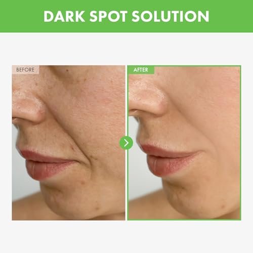TOSOWOONG Kakadu Plum Blemish Cream – Dark Spot Remover & Brightening Face Cream with 600,000ppm Kakadu Plum Extract, Niacinamide & Adenosine – Korean Skin Care, 1.76 oz - görsel 4