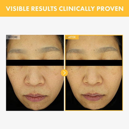 TOSOWOONG 8 Days Spot Cream - Dark Spot Remover for Face with Niacinamide, Age Spot & Sun Spot Corrector, 50g Avelisse