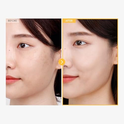TOSOWOONG 8 Days Spot Cream - Dark Spot Remover for Face with Niacinamide, Age Spot & Sun Spot Corrector, 50g Avelisse
