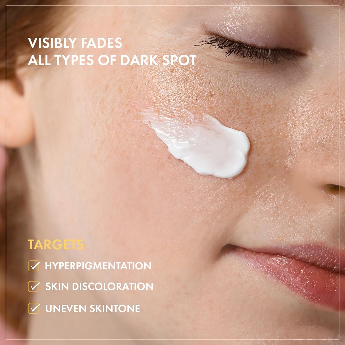 TOSOWOONG 8 Days Spot Cream - Dark Spot Remover for Face with Niacinamide, Age Spot & Sun Spot Corrector, 50g Avelisse