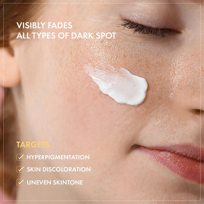 TOSOWOONG 8 Days Spot Cream - Dark Spot Remover for Face with Niacinamide, Age Spot & Sun Spot Corrector, 50g Avelisse