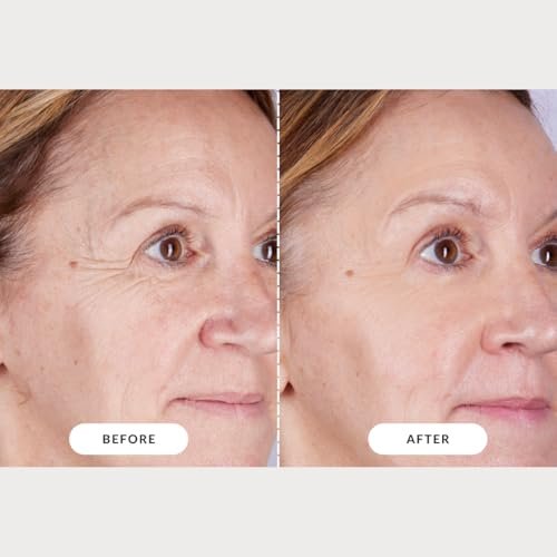 CurrentBody Skin LED Light Therapy Mask: Series 2 – Professional-Grade Anti-Aging & Acne Treatment at Home Avelisse