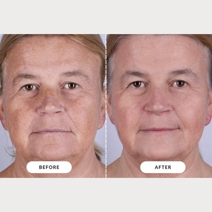 CurrentBody Skin LED Light Therapy Mask: Series 2 – Professional-Grade Anti-Aging & Acne Treatment at Home Avelisse