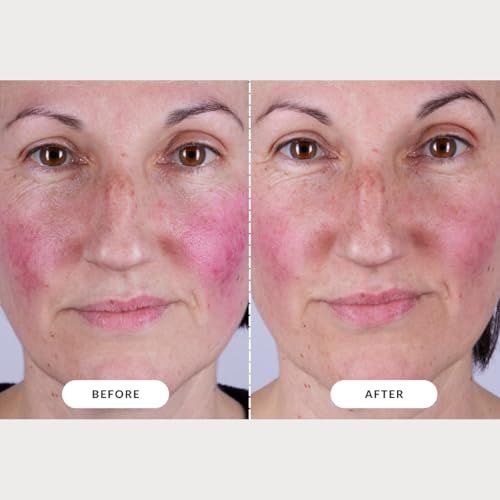 CurrentBody Skin LED Light Therapy Mask: Series 2 – Professional-Grade Anti-Aging & Acne Treatment at Home Avelisse