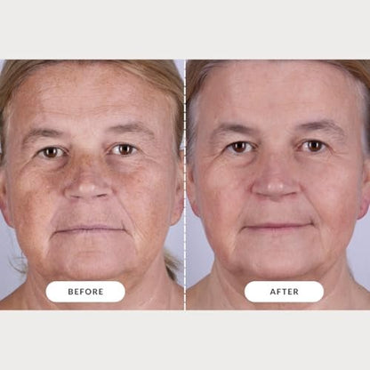 CurrentBody Skin LED Light Therapy Mask: Series 2 – Professional-Grade Anti-Aging & Acne Treatment at Home Avelisse