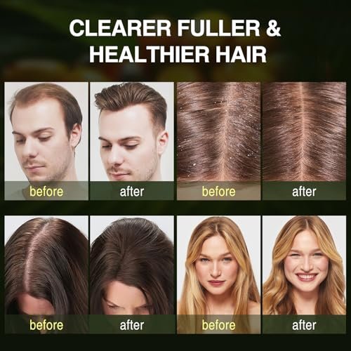Batana Oil Hair Growth Shampoo - Strengthening Regrowth Shampoo for Men & Women with Thinning Hair & Hair Loss, Infused with Rosemary & Mint Oil, Nourishes Scalp, Sulfate Free, 10.15 fl oz Avelisse