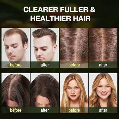 Batana Oil Hair Growth Shampoo - Strengthening Regrowth Shampoo for Men & Women with Thinning Hair & Hair Loss, Infused with Rosemary & Mint Oil, Nourishes Scalp, Sulfate Free, 10.15 fl oz Avelisse