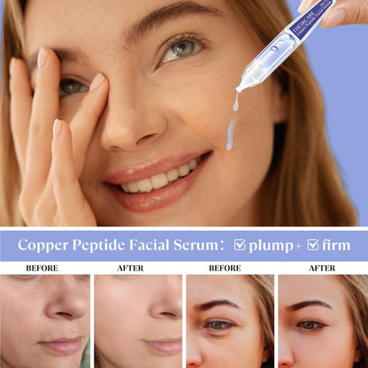 THESKCARE Copper Peptide Serum Ampoule with Niacinamide & Hyaluronic Acid – Hydrating, Anti-Wrinkle, Plumping Face Serum (30 Ampoules, 1.01 Fl Oz) Avelisse