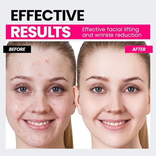 Hunvva Microcurrent Facial Device with Red Light Therapy – Lift, Tighten, and Smooth Wrinkles at Home Avelisse