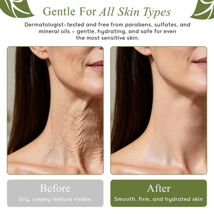 M.D. Blend Crepe-Ease Body Moisturizer – Anti-Aging Retinol Cream for Crepey Skin on Neck, Arms & Legs, Firming & Hydrating, 4 oz Avelisse