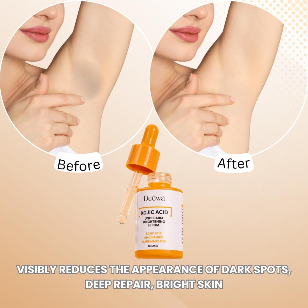 Kojic Underarm Brightening Serum with Niacinamide for Dark Spots, Elbows, Knees, Private Areas - Paraben-Free, Vegan, 1 Fl Oz Avelisse