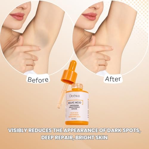 Kojic Underarm Brightening Serum with Niacinamide for Dark Spots, Elbows, Knees, Private Areas - Paraben-Free, Vegan, 1 Fl Oz Avelisse