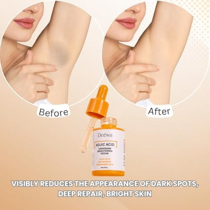 Kojic Underarm Brightening Serum with Niacinamide for Dark Spots, Elbows, Knees, Private Areas - Paraben-Free, Vegan, 1 Fl Oz Avelisse