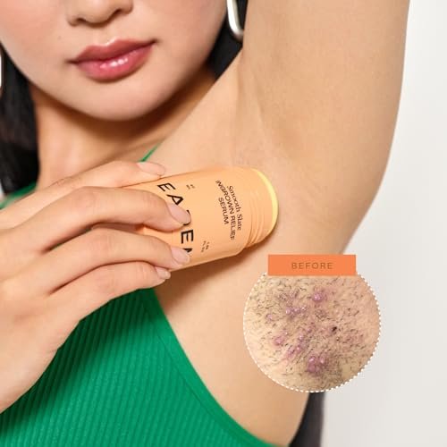 EADEM Smooth Slate Ingrown Hair Roller Serum - Targets Bumps & Trapped Hairs, Fades Dark Spots with AHAs & Tyrosinase, Slows Ingrown Hair Regrowth Avelisse