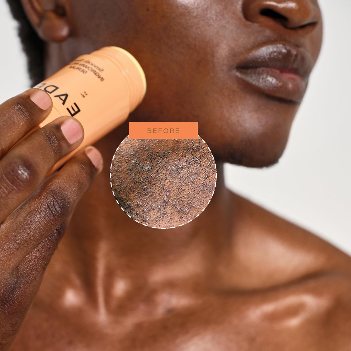 EADEM Smooth Slate Ingrown Hair Roller Serum - Targets Bumps & Trapped Hairs, Fades Dark Spots with AHAs & Tyrosinase, Slows Ingrown Hair Regrowth Avelisse