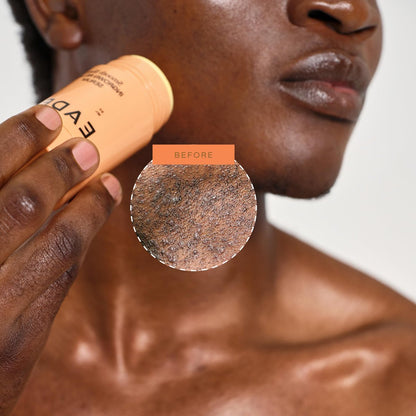 EADEM Smooth Slate Ingrown Hair Roller Serum - Targets Bumps & Trapped Hairs, Fades Dark Spots with AHAs & Tyrosinase, Slows Ingrown Hair Regrowth Avelisse