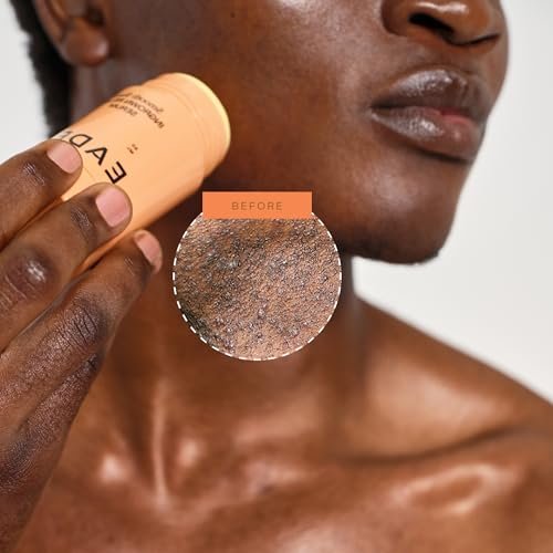 EADEM Smooth Slate Ingrown Hair Roller Serum - Targets Bumps & Trapped Hairs, Fades Dark Spots with AHAs & Tyrosinase, Slows Ingrown Hair Regrowth Avelisse