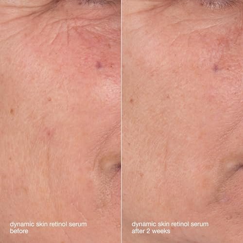Dermalogica Skin Aging Solutions Kit - Anti-Aging Skincare Set with Face Cleanser, Serum, Moisturizer SPF & Cream (Travel Size) Avelisse