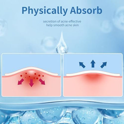Daolyo Pimple Patches for Face - 510 Count Hydrocolloid Acne Patches with Salicylic Acid, Tea Tree Oil & Calendula Oil (8mm, 10mm, 12mm)