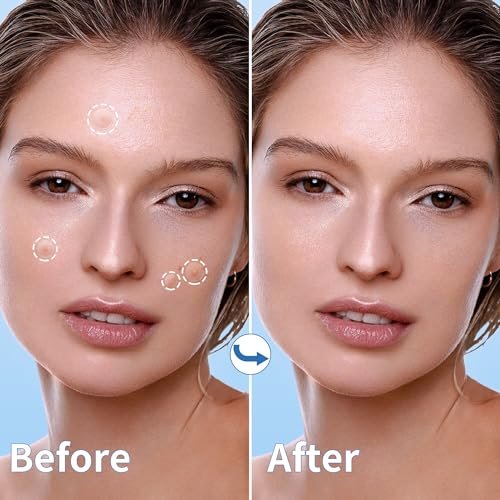Daolyo Pimple Patches for Face - 510 Count Hydrocolloid Acne Patches with Salicylic Acid, Tea Tree Oil & Calendula Oil (8mm, 10mm, 12mm) - görsel 10