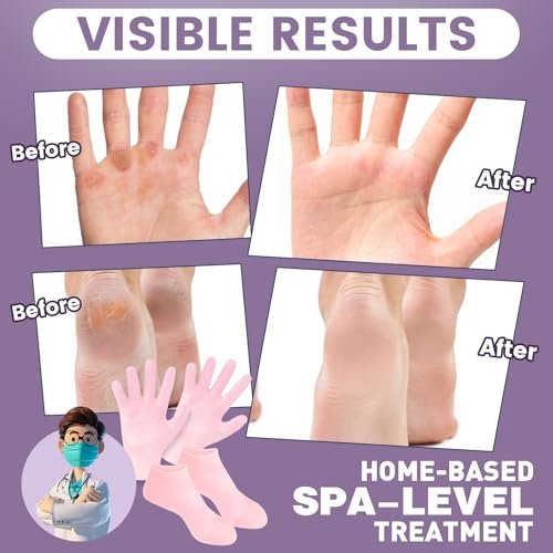 TEAWOO 4 Pairs Silicone Socks & Gloves Set for Dry Cracked Feet and Hands - Reusable Moisturizing Foot Socks for Women - görsel 6