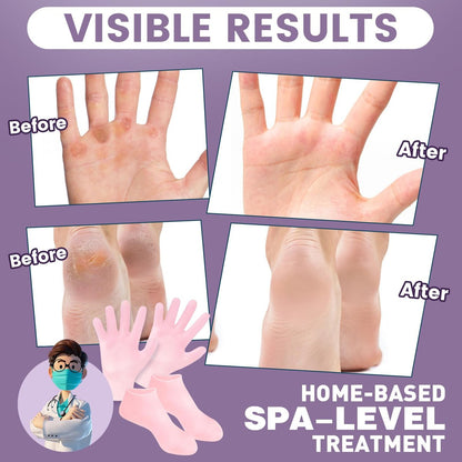 TEAWOO 4 Pairs Silicone Socks & Gloves Set for Dry Cracked Feet and Hands - Reusable Moisturizing Foot Socks for Women