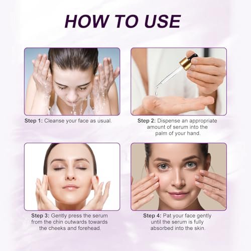 Azelaic Acid 10% Serum with Niacinamide & Hyaluronic Acid - Acne Treatment, Redness Relief, Rosacea Skin Care & Radiance Booster - 1 Fl Oz Avelisse