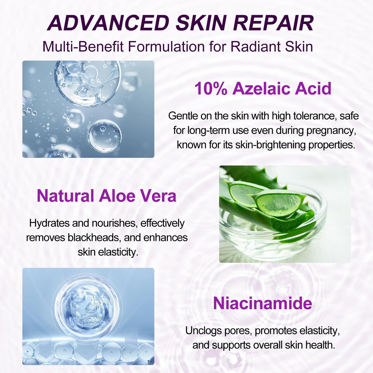 Azelaic Acid 10% Serum with Niacinamide & Hyaluronic Acid - Acne Treatment, Redness Relief, Rosacea Skin Care & Radiance Booster - 1 Fl Oz Avelisse