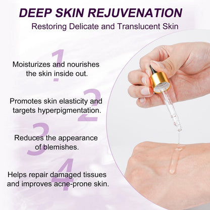 Azelaic Acid 10% Serum with Niacinamide & Hyaluronic Acid - Acne Treatment, Redness Relief, Rosacea Skin Care & Radiance Booster - 1 Fl Oz Avelisse