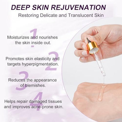 Azelaic Acid 10% Serum with Niacinamide & Hyaluronic Acid - Acne Treatment, Redness Relief, Rosacea Skin Care & Radiance Booster - 1 Fl Oz Avelisse
