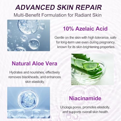 Azelaic Acid 10% Serum with Niacinamide & Hyaluronic Acid - Acne Treatment, Redness Relief, Rosacea Skin Care & Radiance Booster - 1 Fl Oz Avelisse