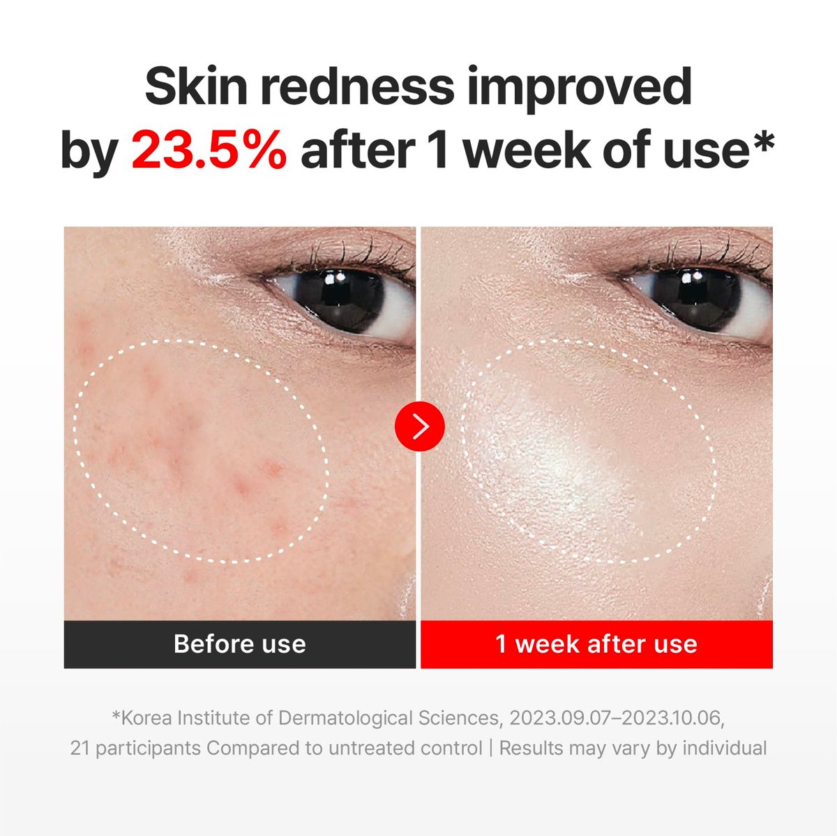 CENTELLIAN 24 Madeca Cream Time Reverse – Advanced Fast-Absorbing & Nourishing Face Moisturizer with Centella Asiatica, 1.69 fl oz (Pack of 2) Avelisse