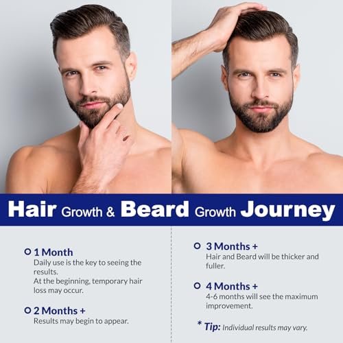 5% Minoxidil Hair Regrowth Spray for Men and Women - 2 Pack Avelisse