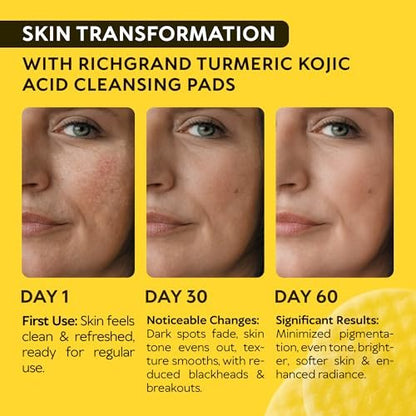 Turmeric Kojic Acid Cleansing Pads for Face - Exfoliating Sponges with Vitamin C & Lemon - Foaming Facial Wash for Glowing Skin & Uneven Tone Support - Gentle Daily Scrub
