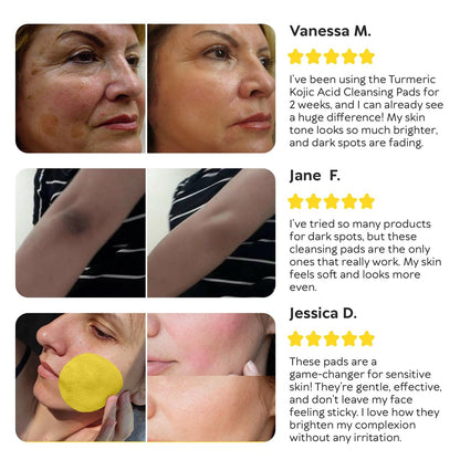 Turmeric Kojic Acid Cleansing Pads for Face - Exfoliating Sponges with Vitamin C & Lemon - Foaming Facial Wash for Glowing Skin & Uneven Tone Support - Gentle Daily Scrub