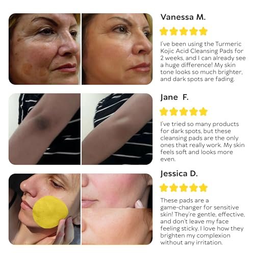 Turmeric Kojic Acid Cleansing Pads for Face - Exfoliating Sponges with Vitamin C & Lemon - Foaming Facial Wash for Glowing Skin & Uneven Tone Support - Gentle Daily Scrub - görsel 16