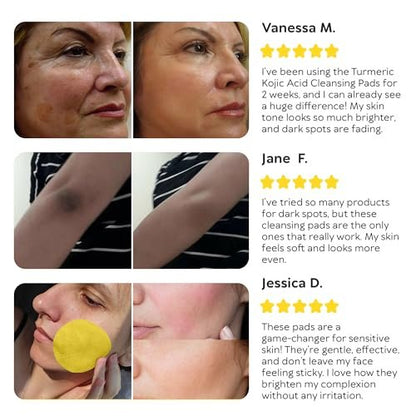 Turmeric Kojic Acid Cleansing Pads for Face - Exfoliating Sponges with Vitamin C & Lemon - Foaming Facial Wash for Glowing Skin & Uneven Tone Support - Gentle Daily Scrub