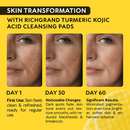Turmeric Kojic Acid Cleansing Pads for Face - Exfoliating Sponges with Vitamin C & Lemon - Foaming Facial Wash for Glowing Skin & Uneven Tone Support - Gentle Daily Scrub