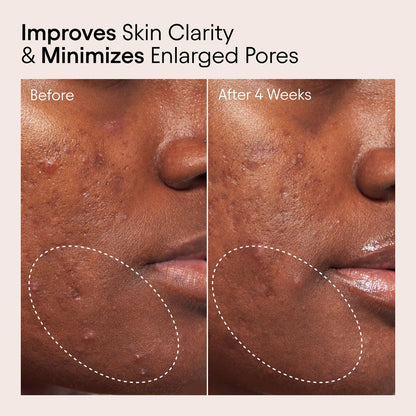 Alpyn Beauty Pore Perfecting Liquid Toner with 2% BHA & Borage – Minimize Pores, Calm & Restore pH (4 oz / 120 ml) Avelisse
