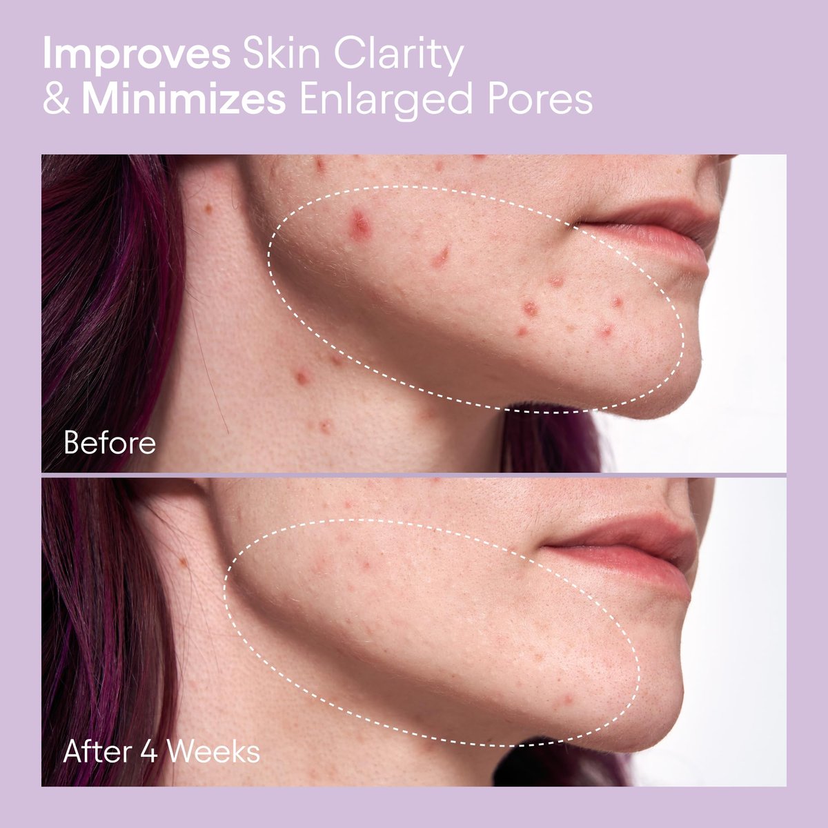 Alpyn Beauty Pore Perfecting Liquid Toner with 2% BHA & Borage – Minimize Pores, Calm & Restore pH (4 oz / 120 ml) Avelisse
