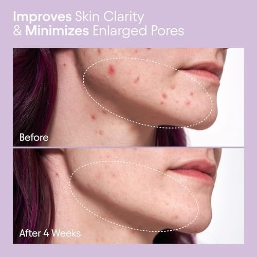 Alpyn Beauty Pore Perfecting Liquid Toner with 2% BHA & Borage – Minimize Pores, Calm & Restore pH (4 oz / 120 ml) Avelisse