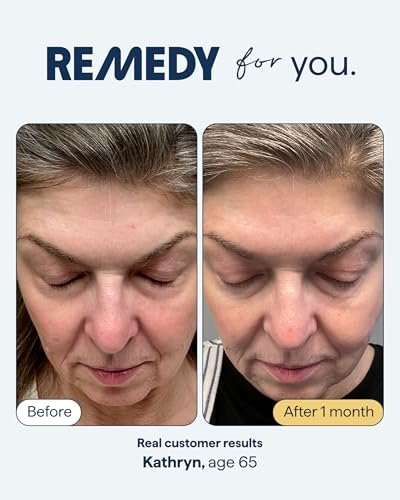 Remedy for Healthy Aging - Retinal, Resveratrol, Glycolic Acid, Argireline, Ferulic Acid, Matrixyl 3000 - Anti-Aging Serum for Wrinkles, Uneven Texture & Tone - By Dermatologist Dr. Shah (1 Fl Oz) Avelisse