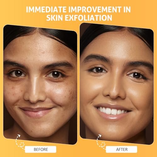 RIHAKO Pumpkin Enzyme Face Mask – Brightening & Exfoliating Facial Mask for Women, Dead Skin, Dullness, Dark Spots, Uneven Skin Tone, Large Pores (3.52 oz) Avelisse
