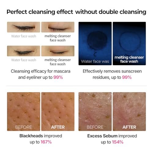 Dr.Melaxin Melting Cleanser - Hypoallergenic Makeup Remover with Quick Bubble Technology, Deep Pore Cleansing for All Skin Types, 150ml Avelisse