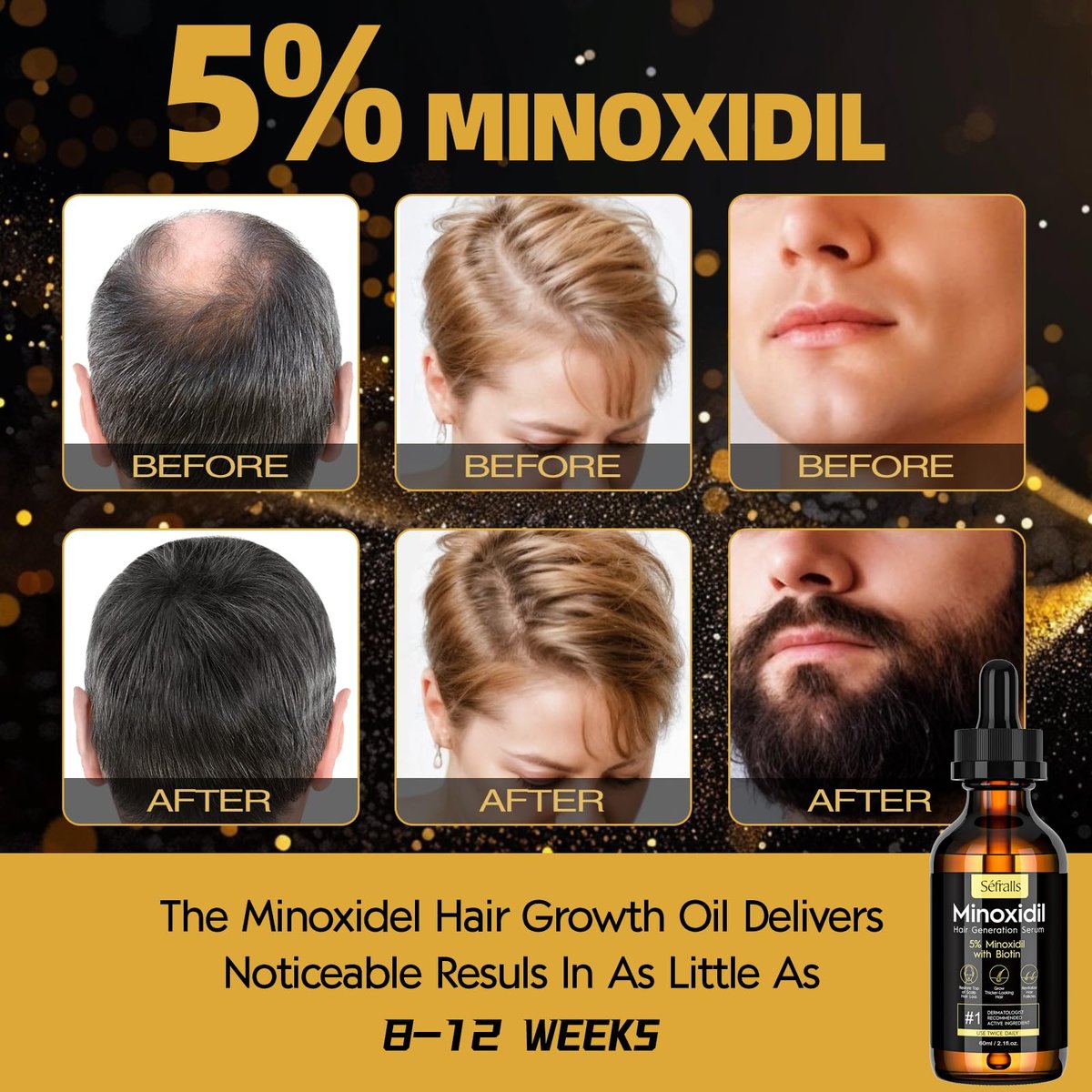 2-Pack 5% Minoxidil Hair Growth Serum for Men and Women - Hair Regrowth Treatment for Stronger, Thicker, Longer Hair & Facial Hair Grooming Avelisse