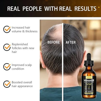 2-Pack 5% Minoxidil Hair Growth Serum for Men and Women - Hair Regrowth Treatment for Stronger, Thicker, Longer Hair & Facial Hair Grooming Avelisse