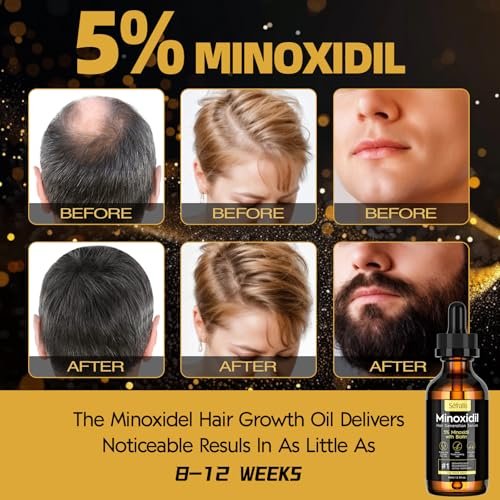 2-Pack 5% Minoxidil Hair Growth Serum for Men and Women - Hair Regrowth Treatment for Stronger, Thicker, Longer Hair & Facial Hair Grooming Avelisse